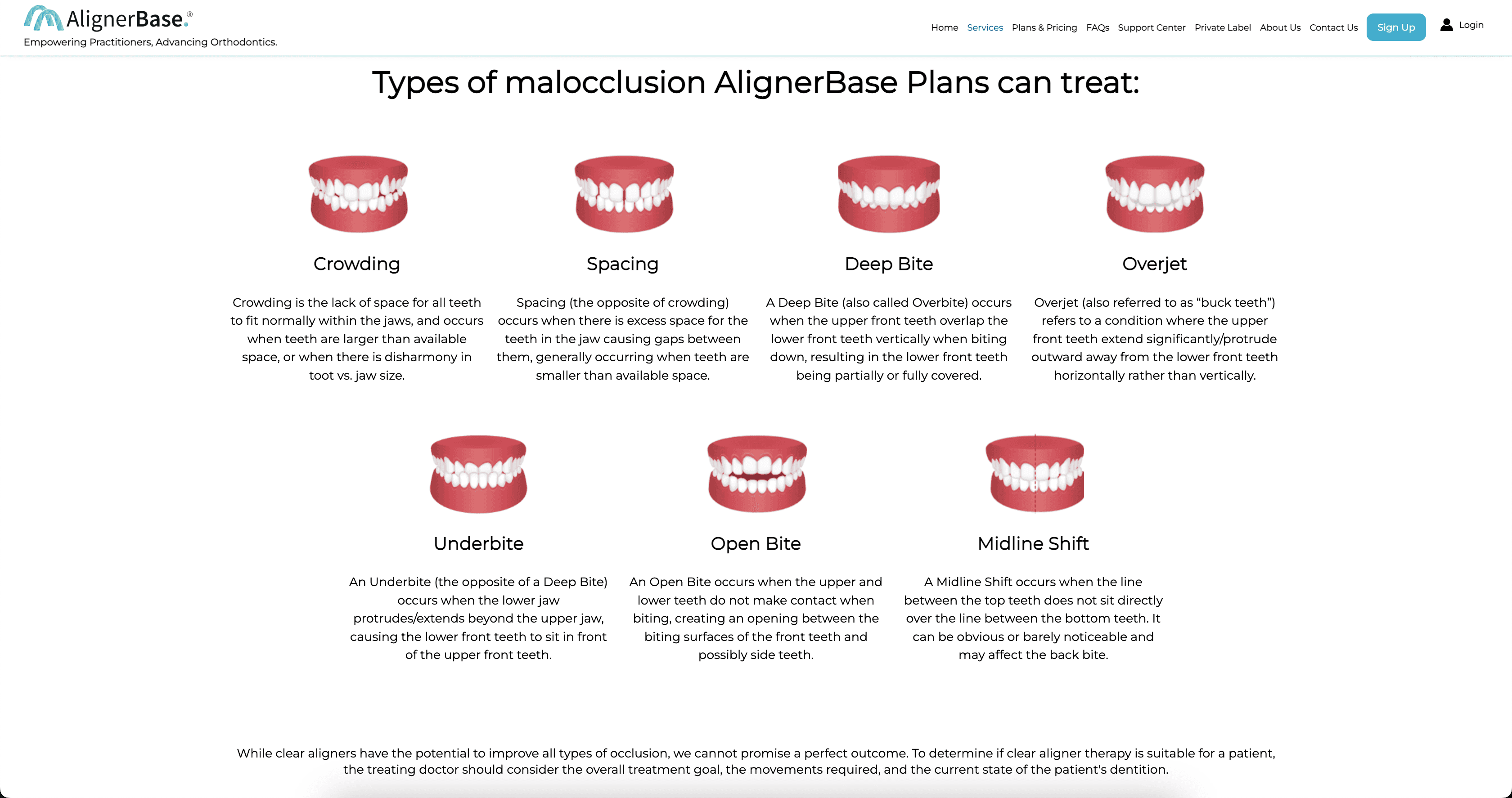 AlignerBase